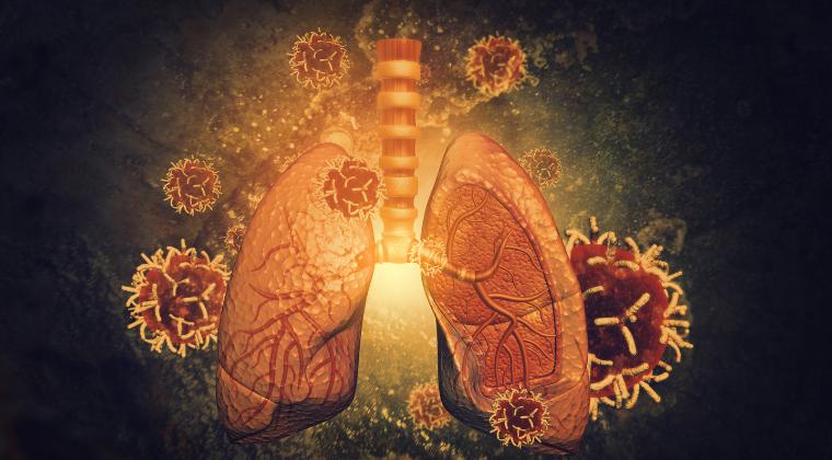 OXC-201 in IPF: A Closer Look