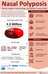 Nasal Polyposis Market