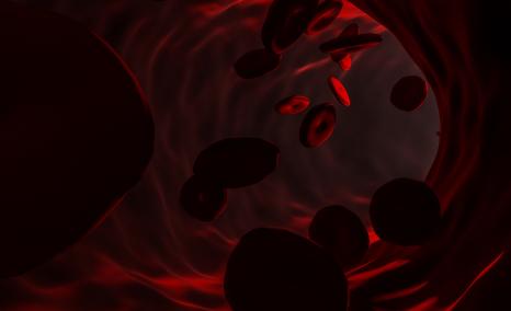 MIDAS Trial Highlights | EHA 2025