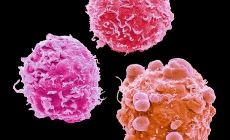Post-CDK4/6 Era in Breast Cancer | ESMO 2026