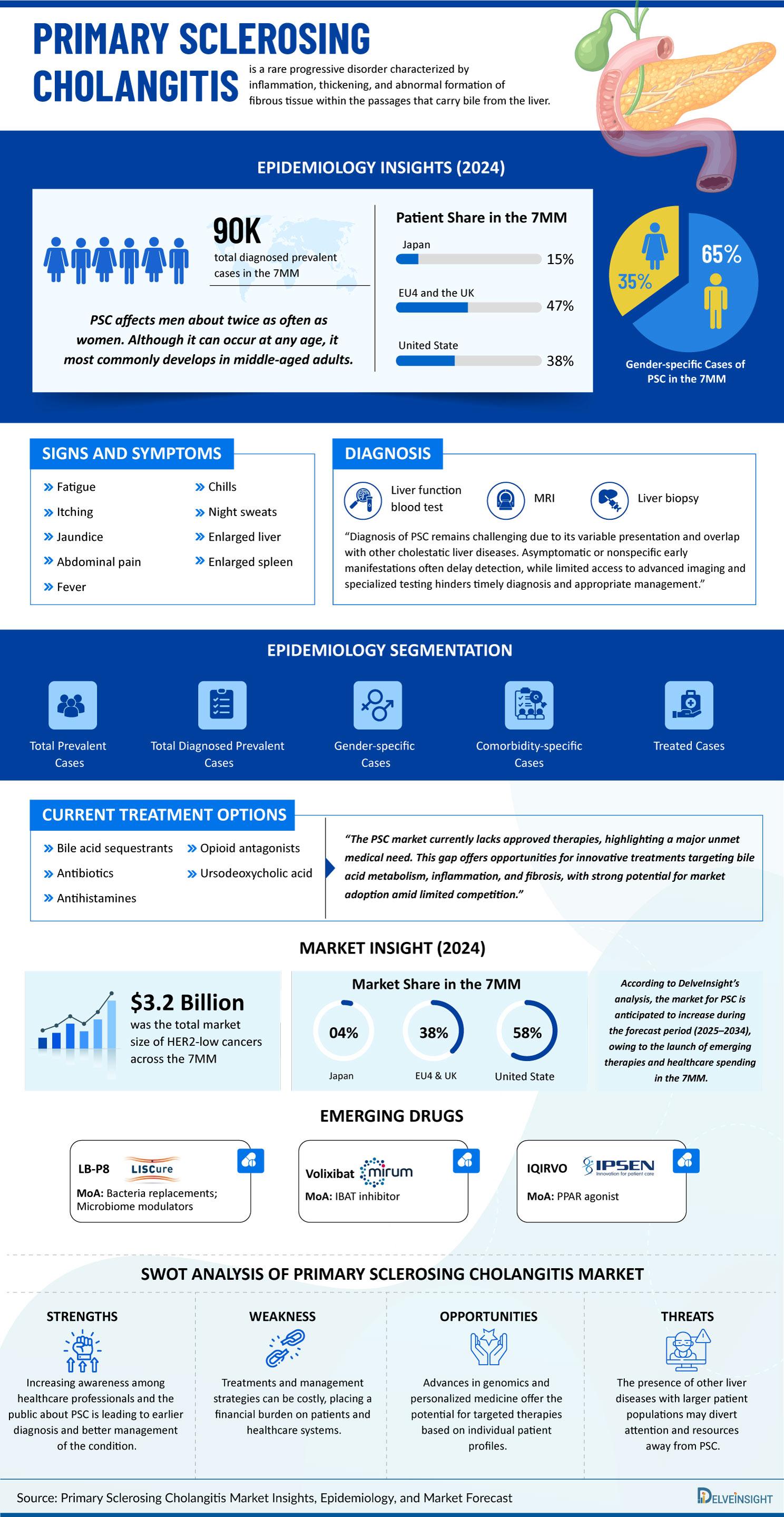 Primary-Sclerosing-Cholangitis