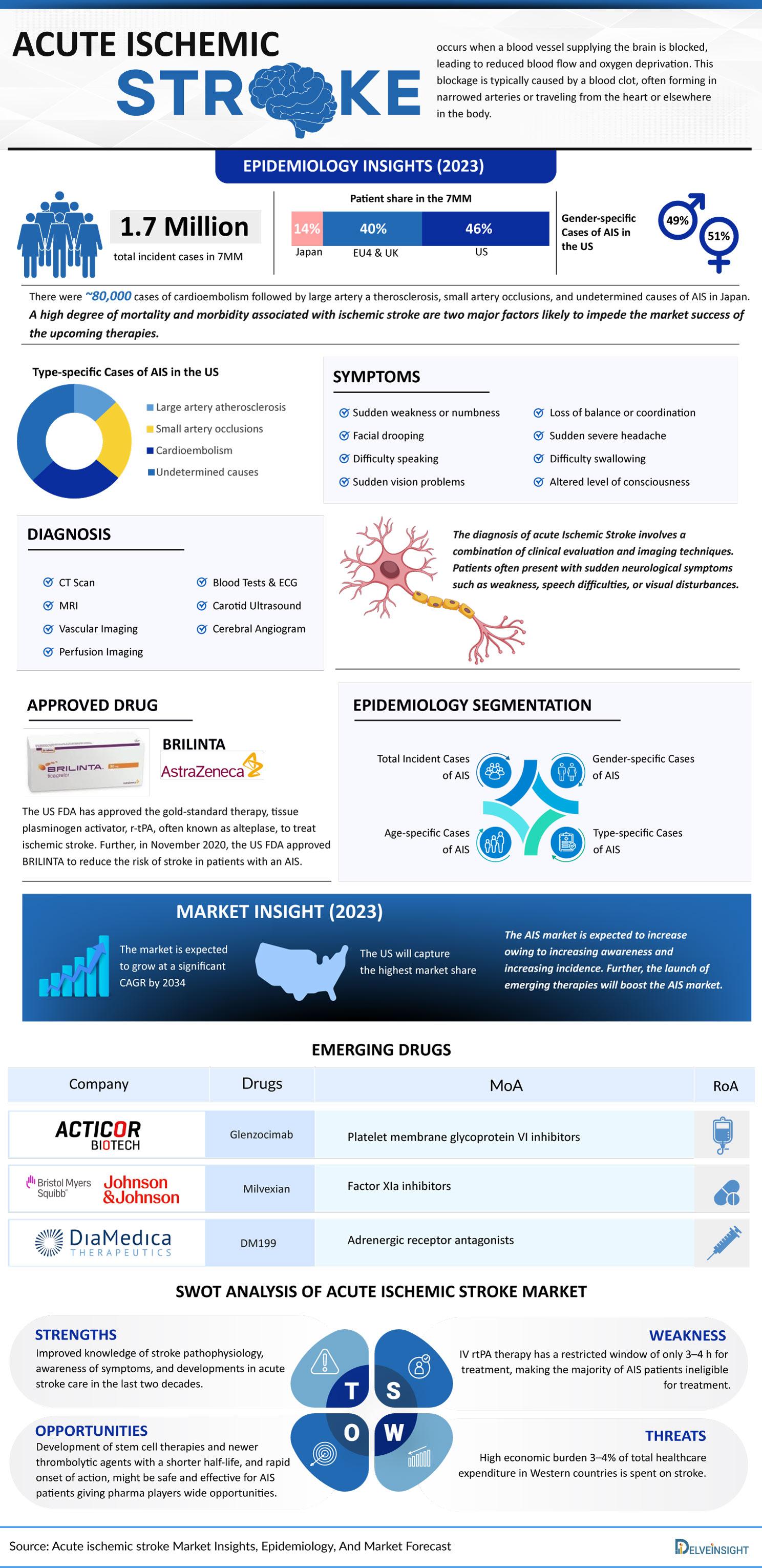 Acute-ischemic-stroke