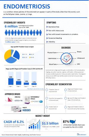 Infographic Image