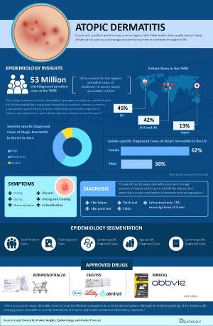Infographic Image
