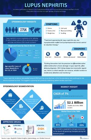 Infographic Image