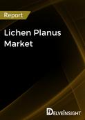 Lichen Planus Market Report