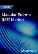 Macular Edema (ME) Market Report