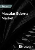 Macular Edema Market Report