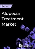Alopecia Treatment Market Report