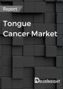 Tongue Cancer Market Report