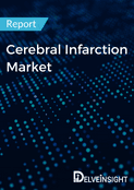 Cerebral Infarction Market Report 