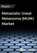 Metastatic Uveal Melanoma Market Report