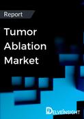 Tumor Ablation Market Report