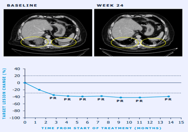 Delveinsight Case Study Visual Delveinsight Case Study Visual