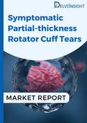Symptomatic Partial-thickness Rotator Cuff Tears Market Report