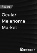 Ocular Melanoma Market Report
