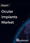 Ocular Implants Market Report