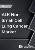 Anaplastic Lymphoma Kinase Non Small Cell Lung Cancer Market Report