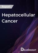 Hepatocellular Carcinoma Market Report