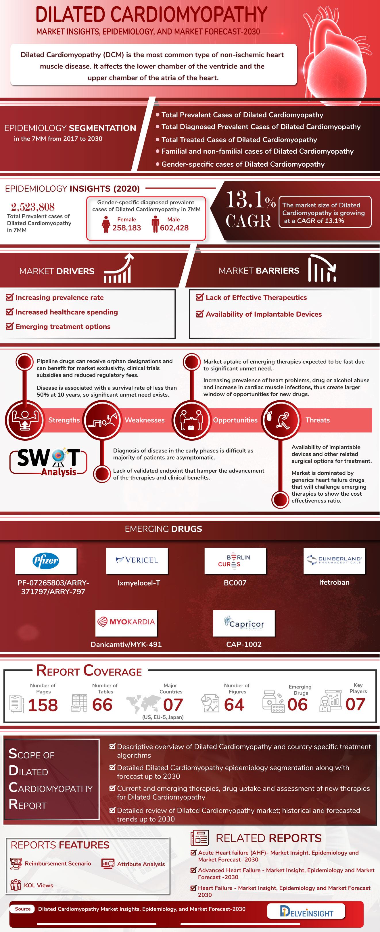 Dilated Cardiomyopathy