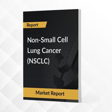 Non-Small Cell Lung Cancer- Market Insight, Epidemiology and Market Forecast -2030" title="Non-Small Cell Lung Cancer- Market Insight, Epidemiology and Market Forecast -2030
