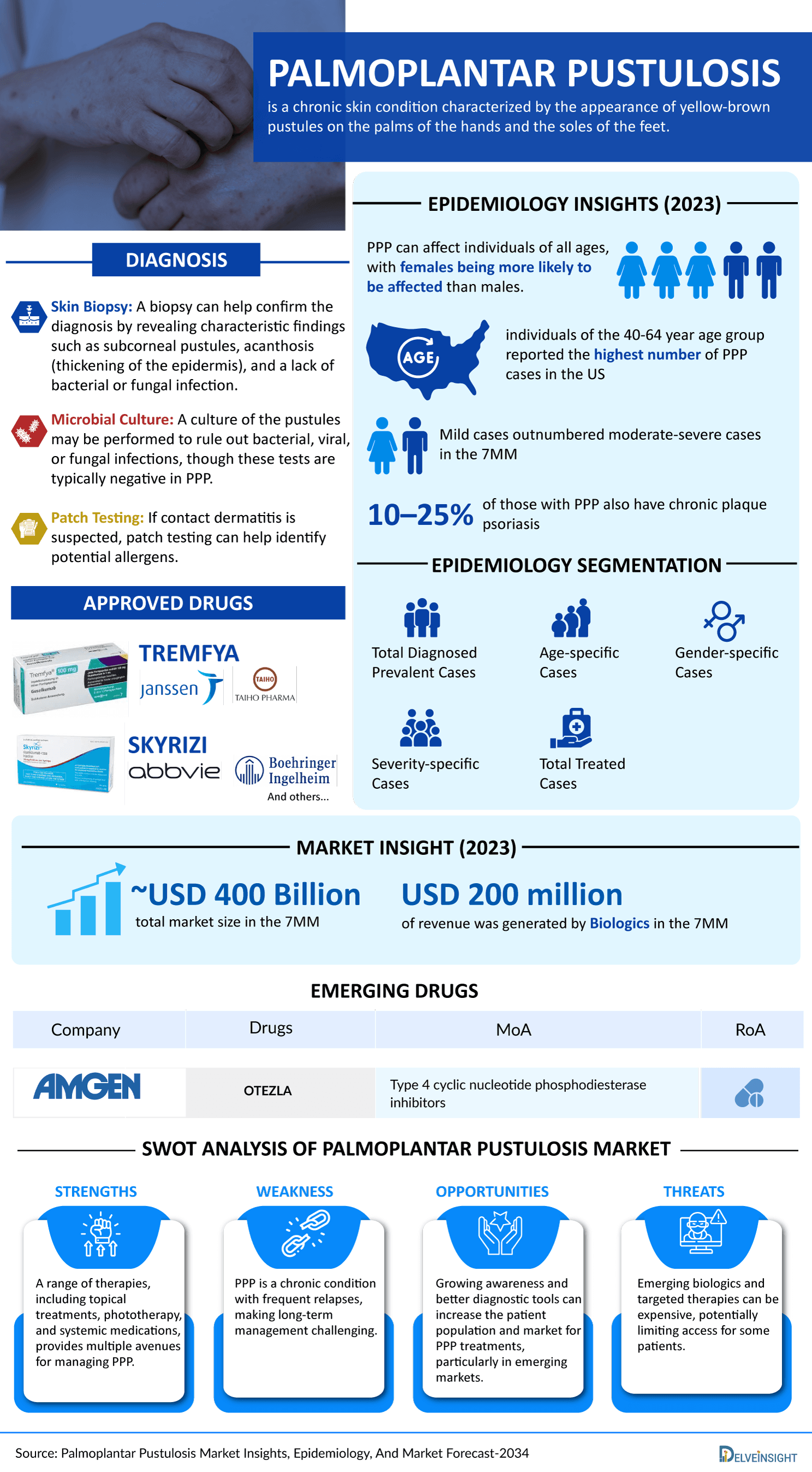 Palmoplantar Pustulosis Infographic