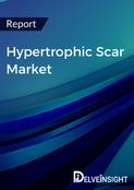 Hypertrophic Scar Market Report