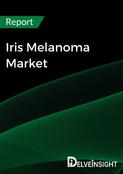 Iris Melanoma Market Report