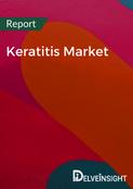 Keratitis Market Report