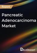 Pancreatic Adenocarcinoma Market Report