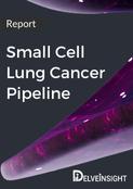 Small Cell Lung Cancer Pipeline Insight