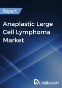 Anaplastic large cell lymphoma (ALCL) Market Report