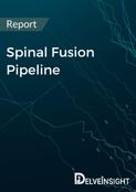 Spinal Fusion Pipeline Report