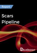 Scars Pipeline Report