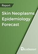 skin-neoplasms-epidemiology-forecast-report