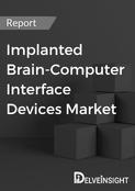 Implanted Brain-Computer Interface (BCI) Devices Market Report