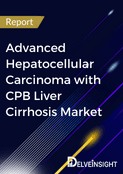 Advanced Hepatocellular Carcinoma with CPB Liver Cirrhosis Market Report