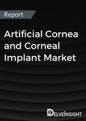 Artificial Cornea and Corneal Implant Market Report