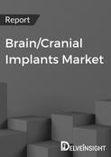 Brain/Cranial Implants Market Report