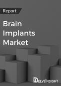 Brain Implants Market Report