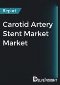 Carotid Artery Stent Market Market Report