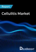 Cellulitis Market report