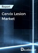 Cervix Lesion Market Report