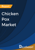 Chicken Pox Market