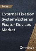 External Fixation System/External Fixator Devices Market Report