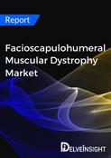 Facioscapulohumeral Muscular Dystrophy Market