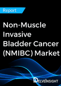 Non-Muscle Invasive Bladder Cancer (NMIBC) Patient Pool Analysis Report