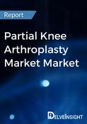 Partial Knee Arthroplasty Market Market Report