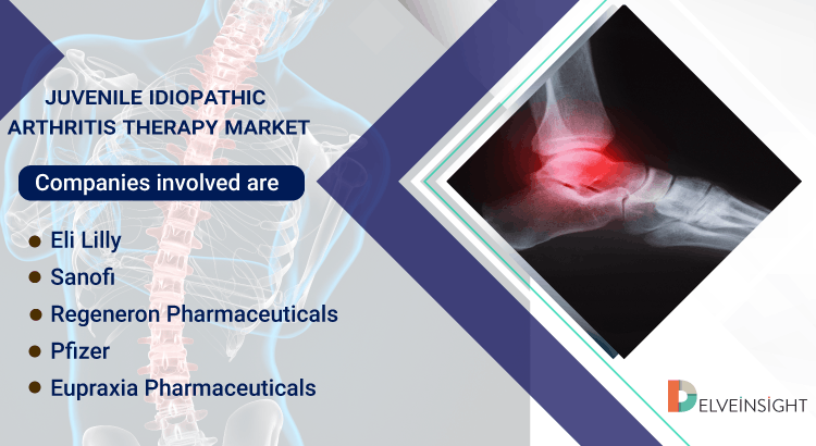 Juvenile Idiopathic Arthritis