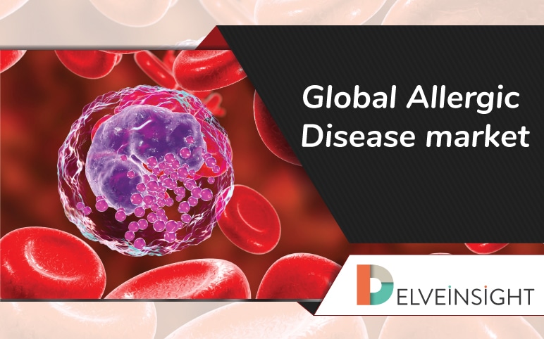 Allergic disease market